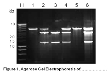 Agarose Gel Electrophoresis of